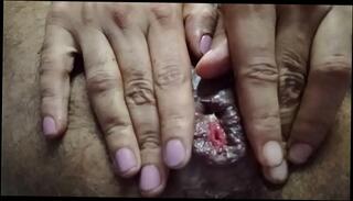 Video 741220865: anal creampie, anal bottle