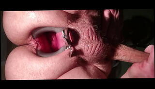 Video 1425241535: gaping anal speculum, gaping spreading ass, gay anal gape, amateur anal gape, homemade gaping