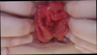 Video 1521731601: prolapse, homemade straight, brutal homemade, homemade rough