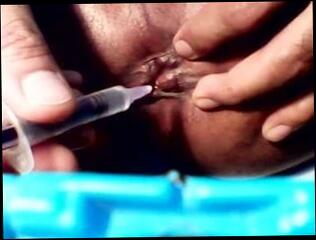 Video 55397201: gay man ass hole, ass injection