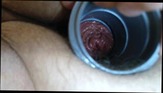 Video 843737501: prolapsed butt, butt plug, gay anal