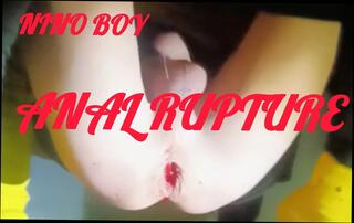 Video 1654714971: femboy sissy anal dildo, femboy dildo solo anal, sissy femboy fingering, twink sissy femboy, skinny femboy twink, skinny gay twink boys, solo fingering pussy masturbating, teen solo finger pussy, young skinny twink boy, twink skinny boy rough, sissy slave boy, sissy femboy amateur, sissy sex slave, uncut twink boy, big dildo solo anal, cute sissy femboy, skinny twink hard, boy handsome twinks, gay man sissy, anal dildo hd, spreads tight ass, ass spread wide, slim ass, sweet ass, guys ass