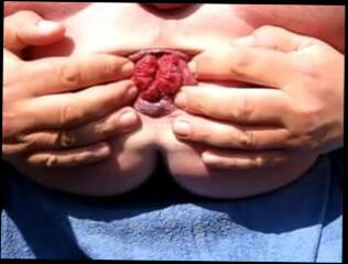 Video 36844801: gaping prolapsed ass hole, gaping ass gay, gape ass hole extrem, gaping porn, monster gaping, gaping man