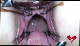 Video 1594650401: wide open, milf pussy doctor, milf gape pussy, milf big clit pussy, amateur gaping pussy, milf toys pussy, milf sex toy, mistress spreads, pussy gape close, european milf toys, german milf toys, milf hd pussy, doctor straight, mistress pleasures, doctor medical, cunt opening, cunt hole, vagina