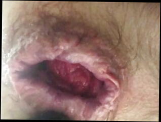 Video 1577424941: anal gaping butt plug, plug gaping ass, anal toys butt plug, anal butt plug sex, amateur butt plug, gay butt plug, extreme butt plug, butt plug close, plug anal french, anal gape hd, penetration gaping