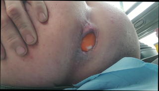 Video 1451335301: anal sex ass gaping, gaping ass fisted, gaping ass toyed, gaping ass gay, gaping amateur ass, ass big anal gapes, cock gaping ass, anal gape hd, tight ass hole anal, american gay sex, ass exercises