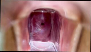 Watch the video about Stella St. Rose - Extreme Cervix Views and Juices Flowing Using a Speculum
