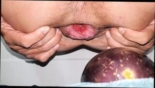 Video 1612565051: double anal fisting prolapse, double penetration anal gape, gaping prolapsed ass hole, double penetration anal hardcore, double anal penetration gay, big ass double penetration, homemade double penetration, double fisting amateur, gaping ass hole close, anal gape hd