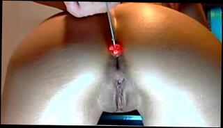 Watch the video about Anal by Lexx