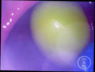 Video 1618409343: pov anal gape, fetish pov, gaping ass toyed, gaping amateur ass, big ass anal pov, anal gape webcam, gaping loose ass, inside gaping ass, gaping ass stretched, gapes wet ass, pov german amateur, alien ass, pov camera