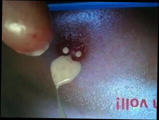 Video 136183701: titten, man gay
