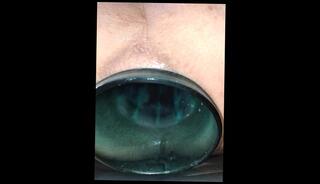 Video 1594904693: fetish bdsm anal, fetish hardcore bdsm, bdsm fetish sex, bdsm fetish amateur, bdsm solo, bdsm anal fisting, solo male sex toy, rough bdsm anal