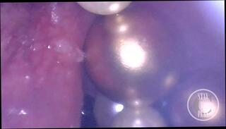 Video 1626923901: crossdresser ladyboy sissy femboy, crossdresser sissy femboy shemale, fetish crossdresser sissy, amateur shemale crossdresser femboy, femboy anal gape, femboy gaping ass, big ass femboy sissy, sissy crossdresser toying, pov anal gape, sissy crossdresser cock, sissy gaping hole, young sissy femboy, gaping pumped, gaping dripping ass, big dick anal gape, anal gape webcam, ass gaping hardcore, gaping ass hole filled, gaping ass hole stretched, ball chain, pov german amateur, ass anal beads, ass cam, austrian amateur