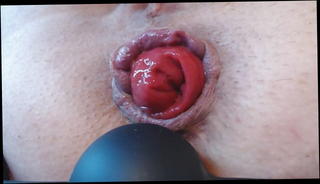 Video 1452825501: anal prolapse play, masturbating straight