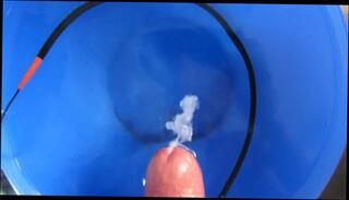 Video 105355301: butt plug ass, bdsm sex toys, bdsm gay porn, amateur bdsm sex, bdsm cumshot, man bdsm, toy huge cumshot, cum shoot huge load, stimulation cumshot, one butt, cum help