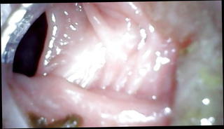 Video 1539575901: bdsm anal fisting, extreme bdsm anal, speculum examination, homemade bdsm, straight bdsm, inserts speculum, speculum deep, speculum exam, medical speculum