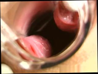 Video 1131862204: fetish blonde, vaginal exam