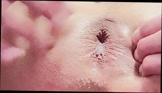 Video 1632151641: gaping ass hole fingered, fingering anal gape, anal gape compilation, anal gape fetish, solo toying compilation, sex fetish compilation, solo masturbation compilation, gay solo compilation, fetish solo porn, amateur fetish compilation, solo play compilation, gaping ass hole stretched, gaping ass hole close, ass gape training, anal gape hd, fucking inflatable