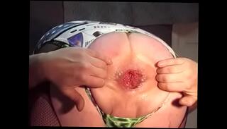 Video 940608285: plug gaping ass, giant plug, ass anal sex toy, ass masturbation sex toy, ass fuck sex toys, hardcore anal ass fucking, gay anal sex ass, amateur ass anal fucked, big ass anal toys