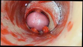 Video 1658989201: creampie pov compilation, amateur creampie cumshot compilation, big cock creampie compilation, hardcore creampie compilation, creampie sex compilation, gay creampie compilation, creampie compilation hd, sex compilation porn, sex toys compilation, cumshot compilation close, croatian cock