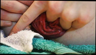 Video 813662801: extreme anal prolapse, skinny anal, skinny gay, nasty ass, wide anal