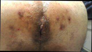 Video 212840001: massage finger ass, fingering ass hole, gay man ass, ass hand