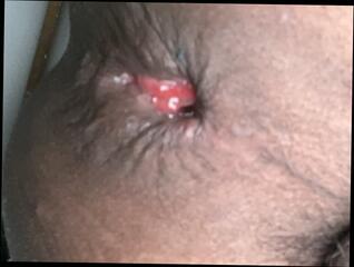 Video 1606100781: fingering anal gape, gaping anal creampie, gaping bareback anal, bareback creampie cum, cock bareback creampie, gay bareback creampie, amateur bareback creampie, grandpa bareback, gape anal boys, bareback young gay boy, old grandpa cum, bareback cum filled, indian gay bareback, stepdad came, gaping deep