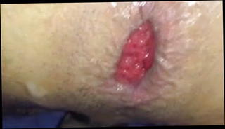 Video 1514406101: gay anal fisting, friend fisting, portuguese anal