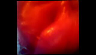 Video 295986735: pumped clit pussy, big clit pump, femdom pussy