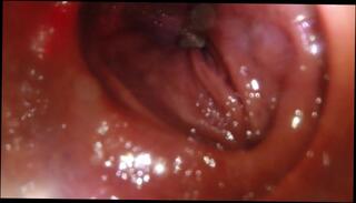 Video 1620843053: vore pov, tiny pov, vore fetish, solo male pov, ass hole anal fetish, pov anal fisting, fetish anal toys, solo amateur toys, giant vore, inside pov, pov camera, pov 60fps, toys stretched