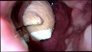 Video 1608015633: fetish gay solo, vore pov, solo male pov, tiny pov, tiny ass anal, fetish anal toys, solo amateur toys, amateur pov deep, giant vore, insertion pov, gut, inside pov, pov camera