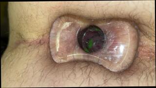 Video 1607464533: anal plug solo, twinks tiny ass, tiny gay twink, fetish twinks anal, solo amateur twink, vore fetish, plugs anal toy, twink toys ass hole, giant anal plug, anal plug insertion, amateur college twink, gay twink male, closeup