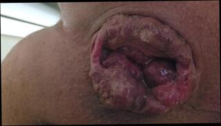 Video 1594302463: bareback creampie cum, bareback anal creampie, amateur bareback creampie, bareback creampie ass, gay bareback creampie, creampie solo, bareback cum inside ass, gay bareback ass hole, creampie cum inside pussy, juicy pussy creampie, mature solo cum, solo male cum, solo man cum, loose ass pussy, squeezes cum