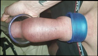 Video 1034601601: penis pump gay, man pumps, penis hd