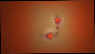 Video 256423101: gaping anal lesbians, bisexual lesbian, balls anal gaping, gaping anally masturbates, gaping anal girl, anal gape close, straight bisexual, gapes two, balls sound, filled balls, anuses