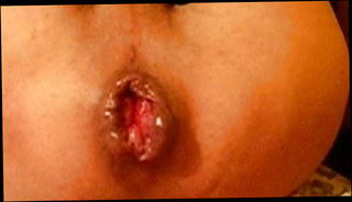 Video 1184686701: sissy anal gape, anal gaping slut, sissy gay anal, natural gaping