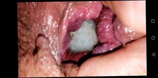 Video 1604777861: gaping prolapsed ass hole, anal gape prolapse, anal sex ass gaping, gaping ass hole toyed, gay gaping ass hole, gaping amateur ass, anal prolapse play, gapes ass inserts, balls prolapse, huge gaping ass hole, gaping fat ass, anal gape hd, gaping german, gay anal sex straight, gay bear sex