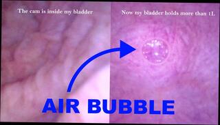 Video 1625770551: sissy gaping hole, sissy pov, sissy pumps, pump piss, fetish pump, shemale trans sissy, dick shemales sissies, sissy shemale masturbate, cock pump masturbation, amateur shemale pov, pov big cock masturbation, cock pov close, european amateur pov, young cock pov, sissy webcam, inflation, austrian amateur