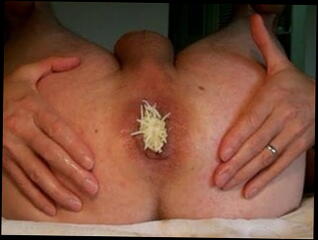 Video 20255201: toys fisting gape, gaping fisting anals, gaping ass fisted, gaping ass gay, anal gape play, insertion gaping, gaping man, little toy play, good toy