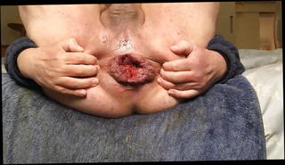 Video 1215626401: anal gape compilation, gaping asses compilation, anal sex ass gaping, gaping anal toying, ass big anal gapes, amateur anal gape, homemade anal gape, gay anal gape