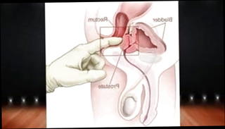 Video 1420834001: pov sex compilation, doctor squirt, squirting babe toying, doctor teacher, doctor straight, squirt training