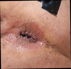 Video 1624322401: gaping fuck hole, gaping arse, fuck hole dildo, gape big toys, gaping hole stretched, love gaping, gay hd