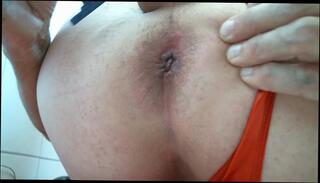 Video 316160701: prolapsed ass, anal prolapse, shaved ass balls, balls straight, ass anal hd