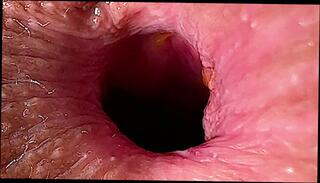 Video 1599637243: fetish ass fingering, fetish babe fingers, finger fucked fetish, fetish teen fingered, finger fucking ass licking, ass fingering anal fucking, amateur teen ass fingering, finger anal ass hole, anal fingering fisting, big ass anal fingering, anal sex fetish old, licking fingering big tit, fingers ass hole plays, anal fingering close, ass fingering first, farting anal, young babe fingering, anal camera