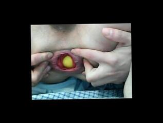 Video 240069301: fisting gape prolapse, toys fisting gape, prolapse gay, cock gaping, gaping sex, gaped amateur, prolapse close, small prolapse