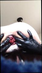 Video 327384101: belladonna, fisting prolapse, plug fisting, prolapse gay, giant prolapse, plugged man, plug hd