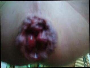 Video 316915001: gaping crossdresser, gaping gay, big gaping hole