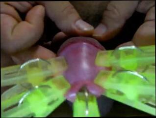 Video 272648701: asian gay bdsm, gaping gay, gaped amateur, gaping man, penis