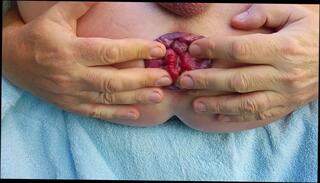 Video 254145801: fisting gape prolapse, anal gape prolapse, self anal fisting prolapse, prolapse fisting ass, amateur anal gape, gay anal gape, anal hole prolapse, huge anal prolapse, gape dirty