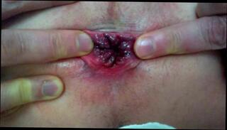 Video 322762601: amateur anal gape, gay anal gape, anal gape play, anal gape hd, ass hole play